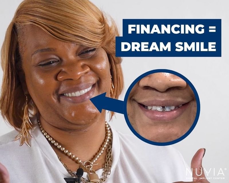 How Much Are Dentures 2025 Guide How much are dentures 2025 guide